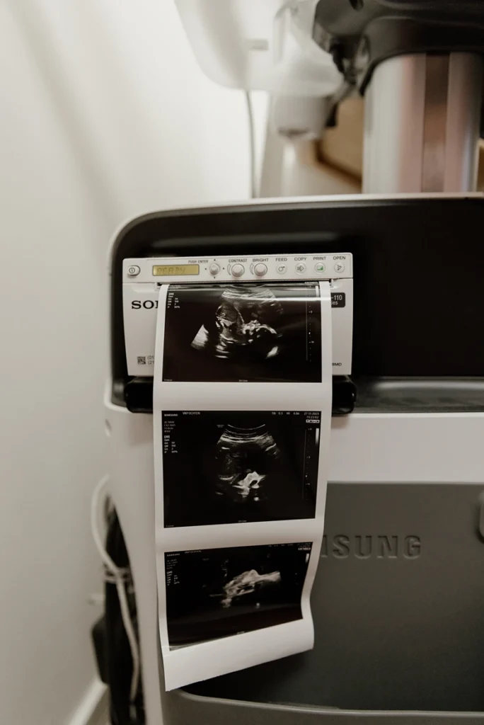 Echografie bij een consult bij de verloskundige
